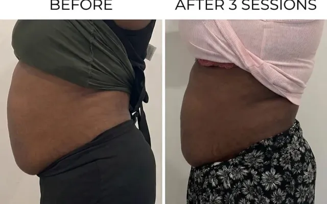 Wumi Signature Sculpt defining a client's waist and tummy